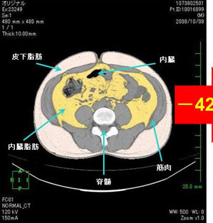 腹囲に関する試験結果